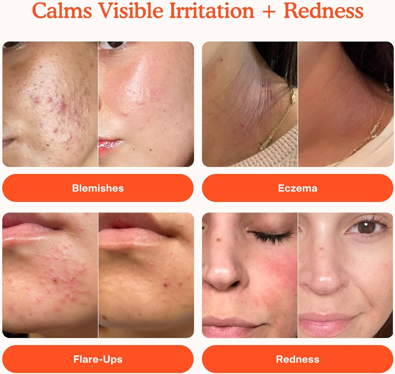 Tower 28 Beauty Mini SOS Daily Rescue Facial Spray 1 Ounces image number 4