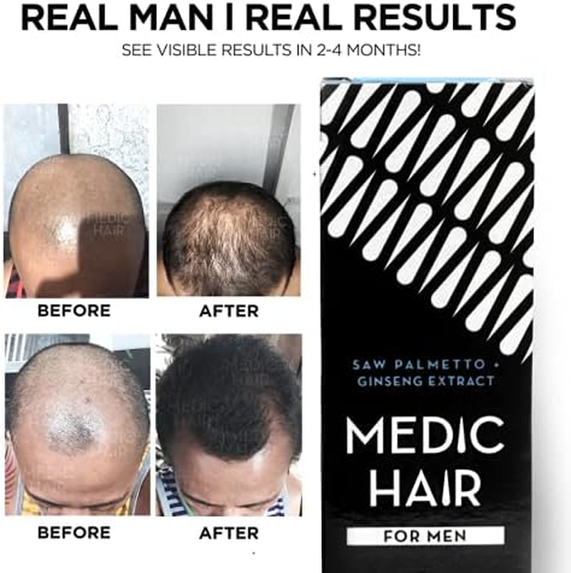 MEDIC HAIR for MEN 90Ml, 3.04 Fl Oz, Contains Saw Palmetto and Ginseng Extract, DHT Blocking, Natural, Healthy Hair Growth image number 3