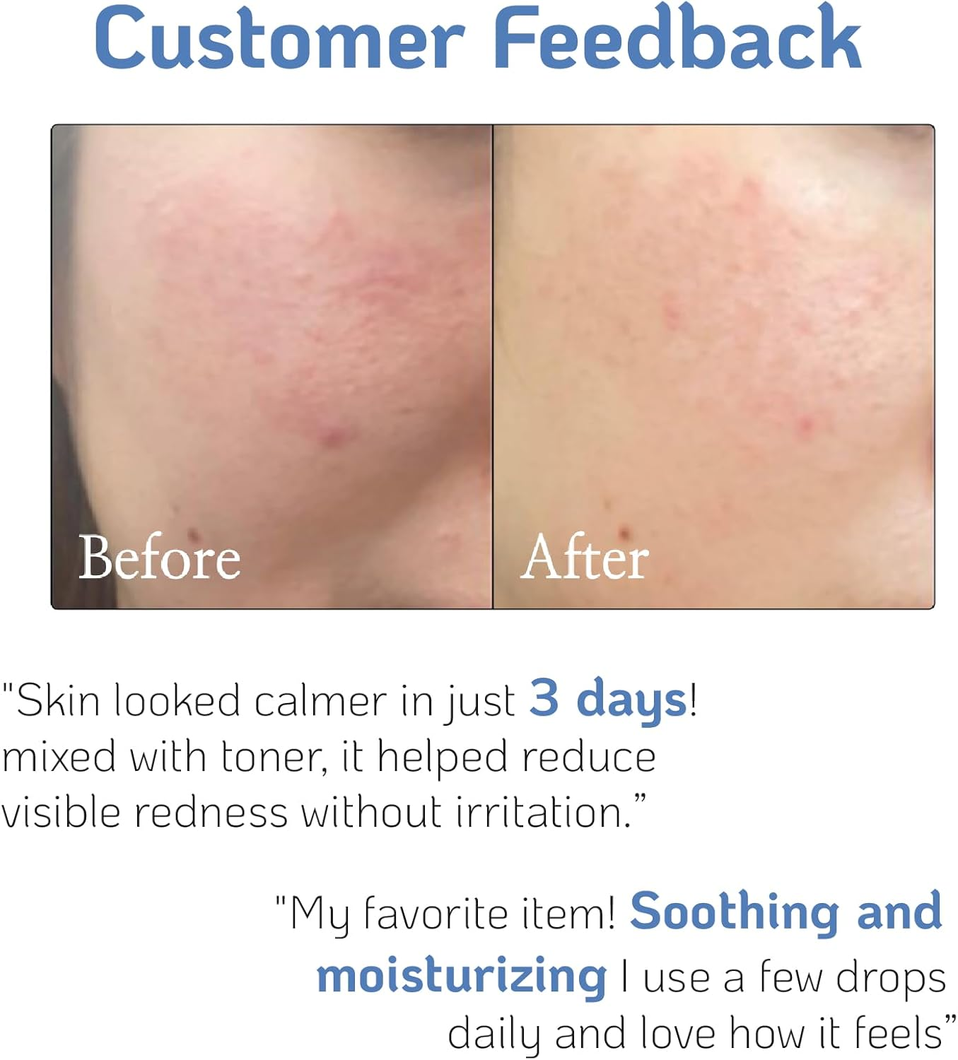 High-Potency Pure D-Panthenol for Intensive Hydration, Calming, and Skin Barrier Recovery with Only a Drop in Your Skincare and Haircare Routine 30Ml 1Fl Oz image number 1