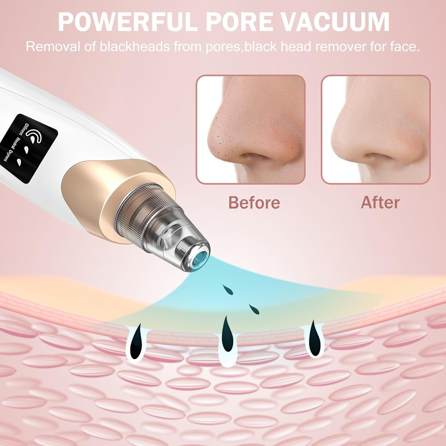 Blackhead Remover Pore Vacuum Kit - 2023 Upgraded Blackhead Extractor Tool with 3 Adjustable Suction Levels, 7 Probes, USB Rechargeable, Suitable for Women and Men image number 2