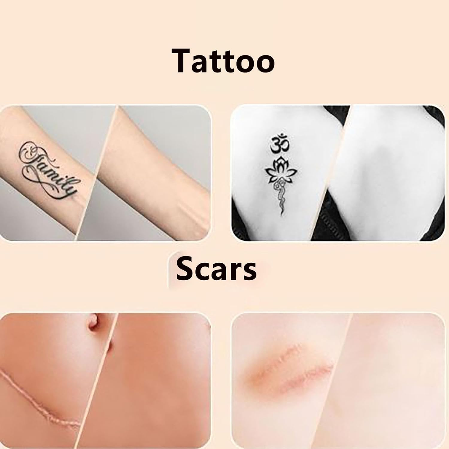 SYGELER Professional Tattoo Cover Tape 10PCS | Ultra-Thin Skin Tone Concealer Patches (8X10Cm) | Waterproof & Breathable for Scars/Birthmarks | Flawless Body Makeup for Weddings/Work image number 2