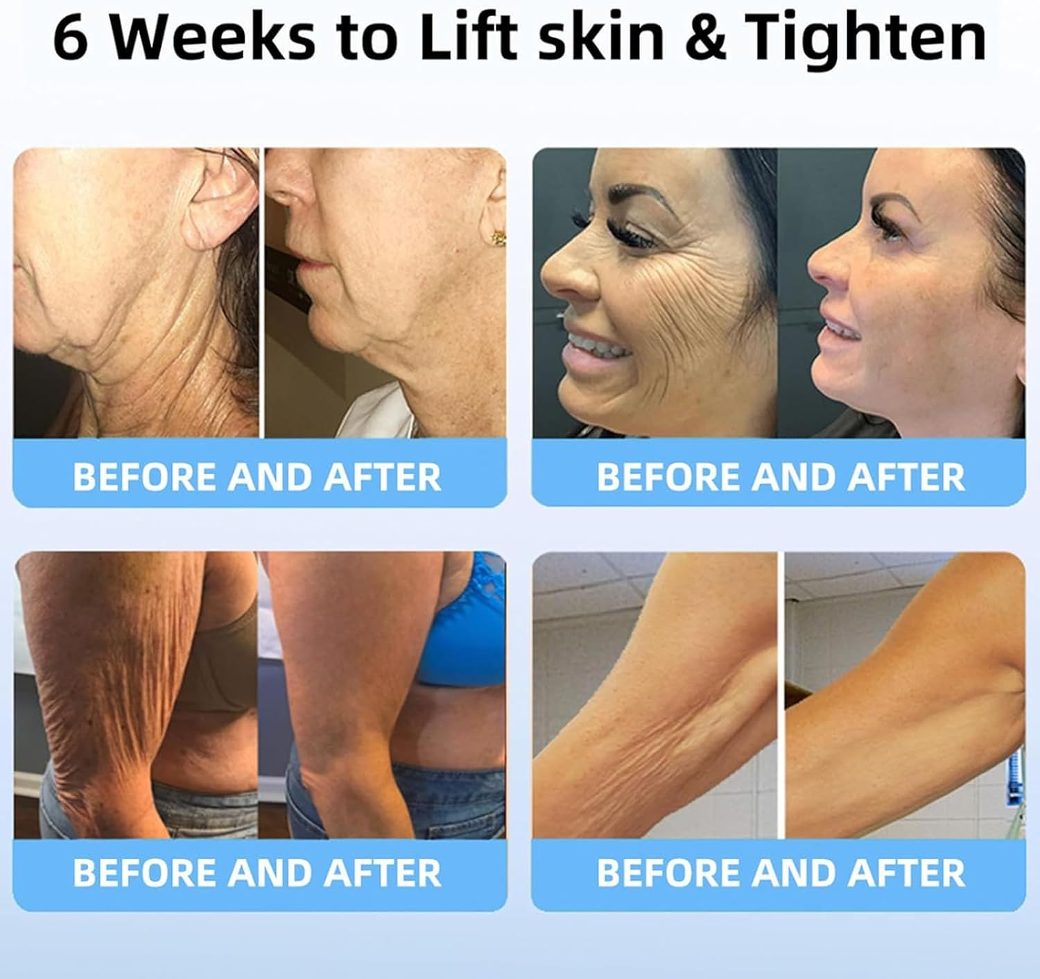 Aeehfengf Firm Tighten Skin Tighten Cream,Firm and Tighten Skin Cream,Aeehfengf Skin Firming Cream,Skin Tightening Cream,Anti-Aging Neck Cream,Skin Firming Protein Cream,Elastin Moisturizer (2Pcs)