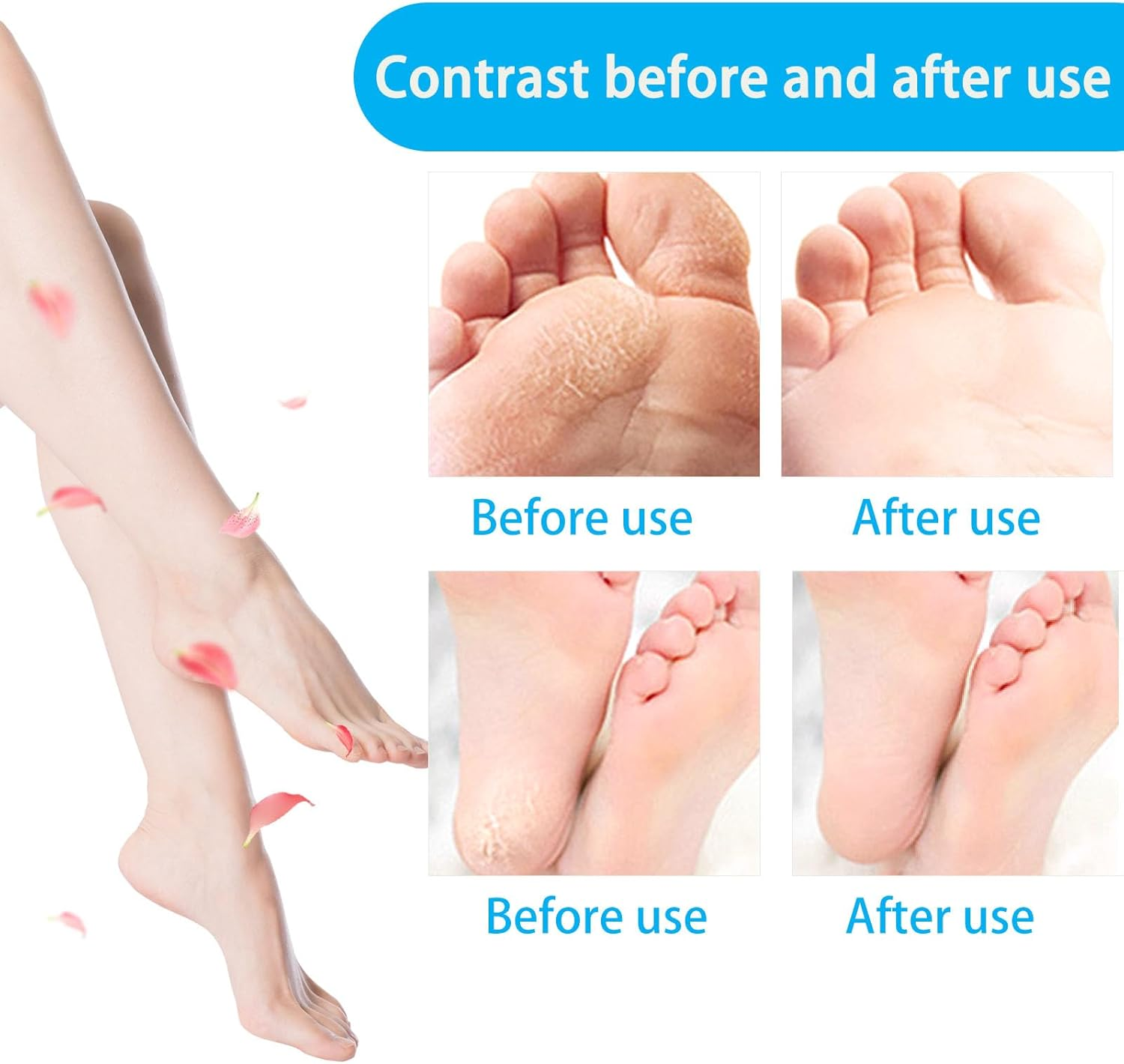 Replacement Rollers for Scholl Callus Remover, Pack of 10 Refills for Electric Foot File, Compatible with Scholl Velvet Smooth, 3 Types of Roughness, Rollers for Pedicure, Pedicure Foot Care Set image number 6