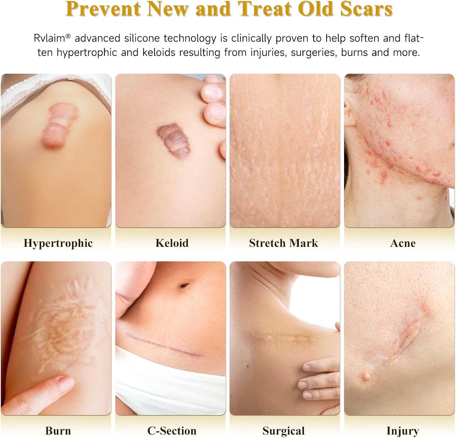 Silicone Scar Cream Scar Gel, Advanced Scar Cream for Surgical Scars, C-Section, Injury, Stretch Marks, Acne, Burns, Keloids, Old & New Scars, 1.85 Oz (55G) image number 6