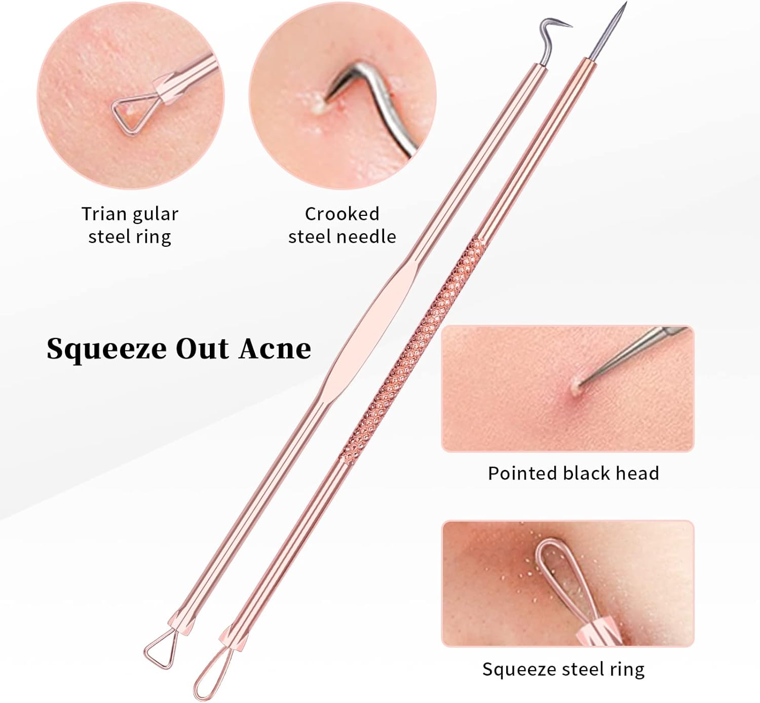 Ducare Blackhead Remover Comedone Extractor Acne Removal Kit for Blemish, 4Pcs Professional Pimple Popper Tool Kit, Stainless Steel (Gold) image number 2
