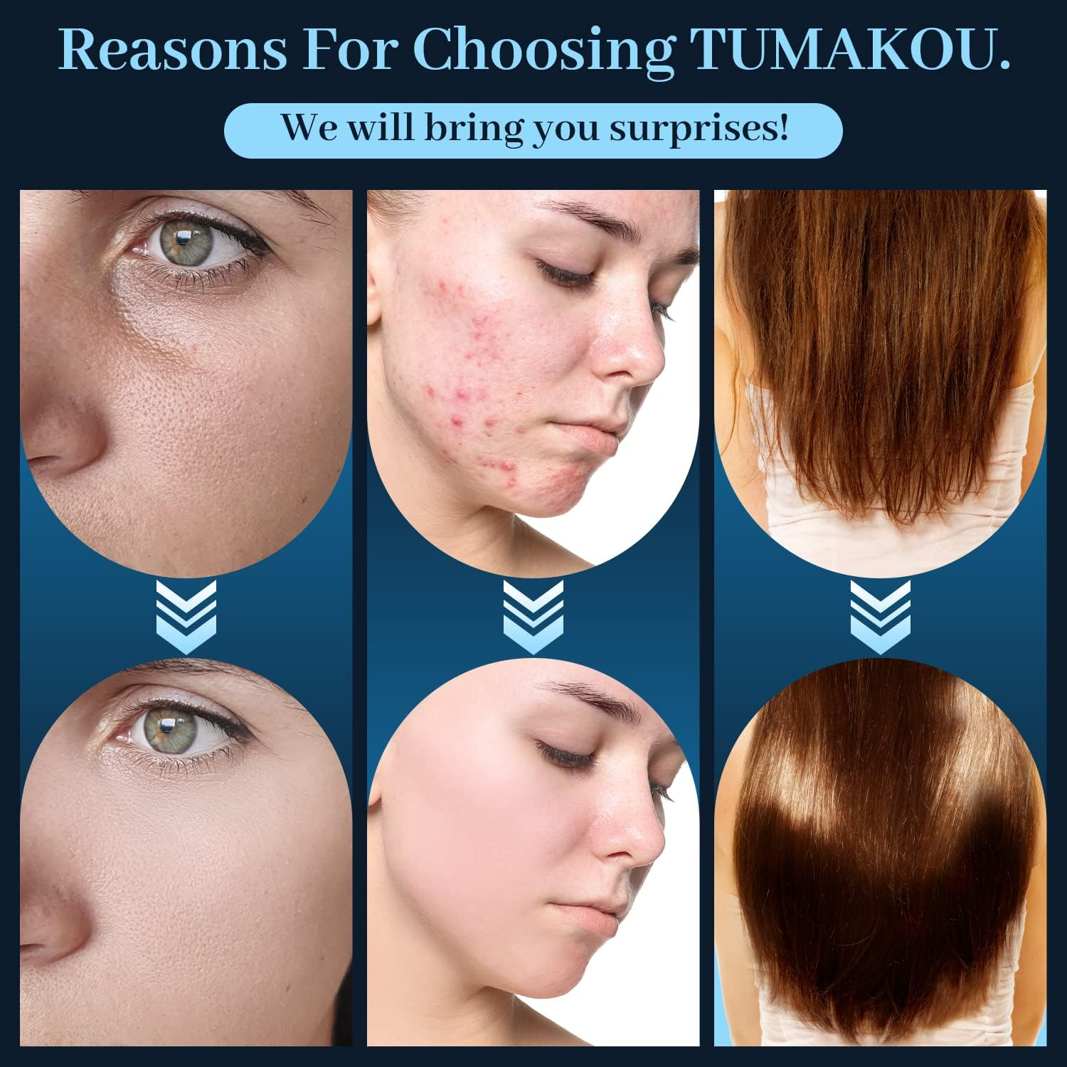 High Frequency Facial Wand - TUMAKOU Portable Handheld Blue High Frequency Facial Machine - 4 Different Blue Glass Tubes for Skin image number 1