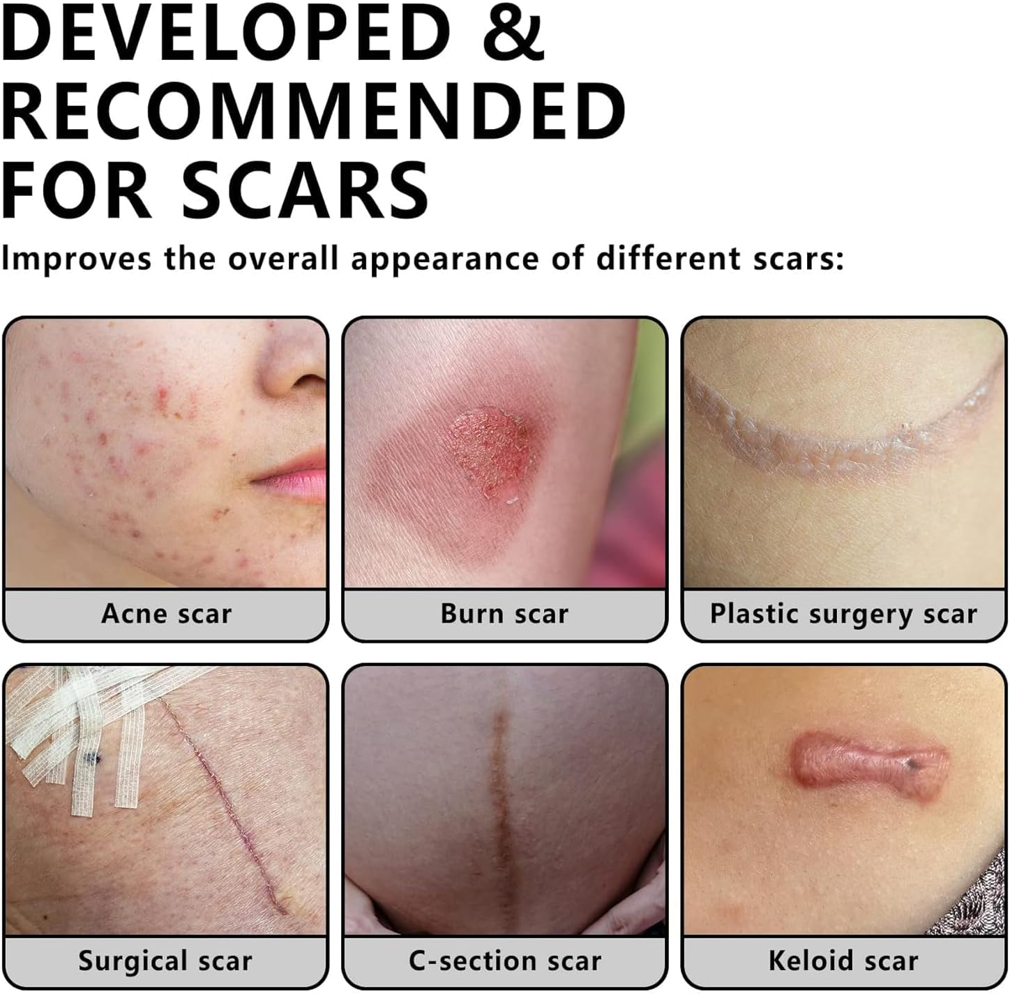 Transparent Silicone Scar Patch Tape ● Reusable, Clear, Invisible, Waterproof, Breathable Strips ● Lightens and Removes Scratches ● for Old and New Scars ● (2,5Cm*150Cm), image number 6