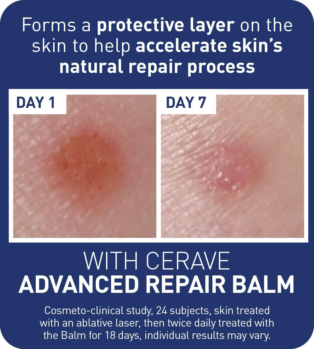 Cerave Advanced Repair Balm 88Ml, for Dry Skin, Hydrates, Soothes & Protects Skin, Developed with Dermatologists image number 6