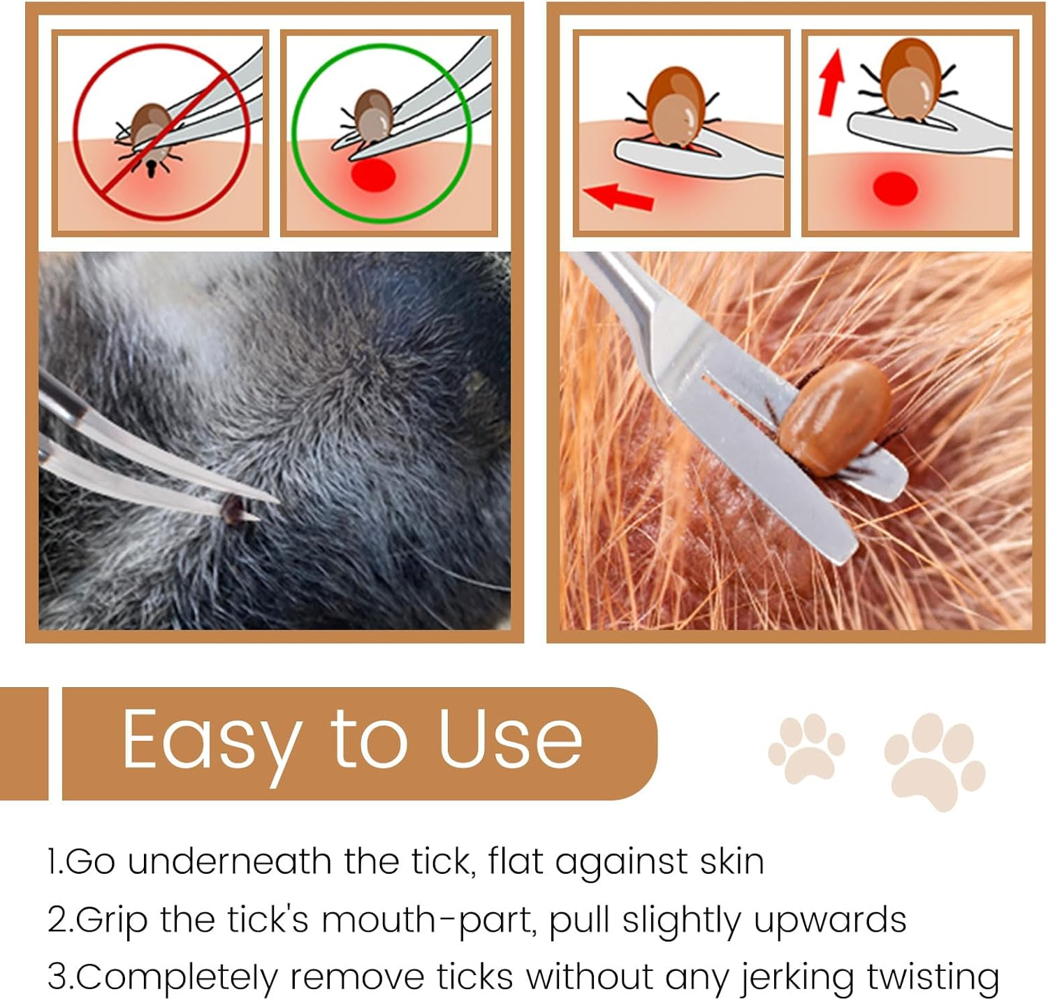 Muorruo 2 Pieces Premium Tick Removal Tool, Tick and Flea Removal Tool Made of Stainless Steel for Pets, Dogs, Cats and People, Safe Tick Remover and Precise Tweezers image number 6