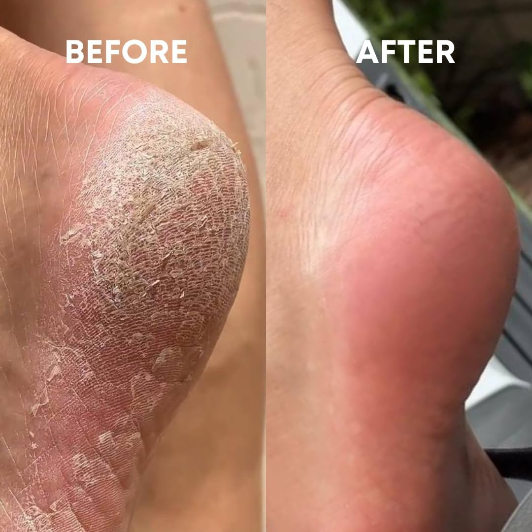 Cheekyglo Glass Foot File | Sensitive Foot File | Coarse Foot File | Callus Remover | Callous Remover | Foot File | Foot Exfoliator (Coarse) image number 1