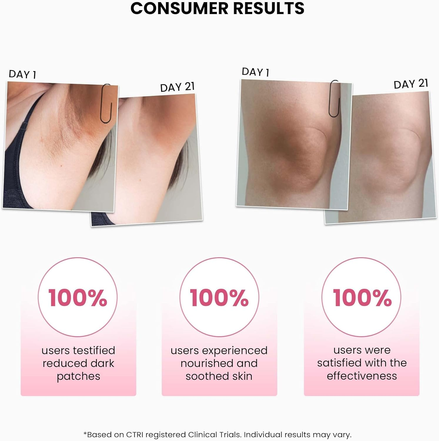 Thriveco Dark Patches Corrector, Depigmenting Cream, for Body Discoloration Neck, Underarms, Elbows & Knees, Non Sticky Triple Action Formula 100Ml Vegan Nonsticky Expert Formula image number 1