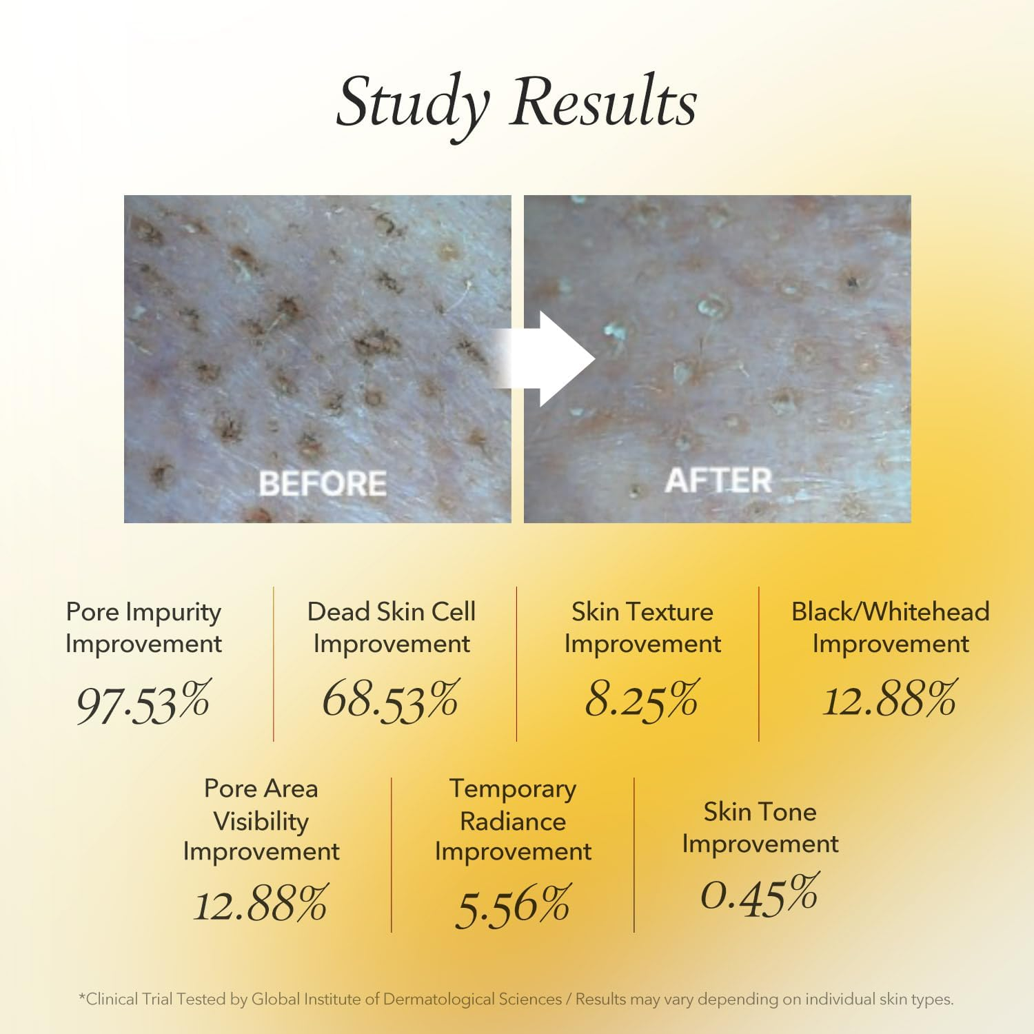 APRILSKIN Calendula Flower-Infused Facial Peel off Mask, 3.52 Fl. Oz, PHA, BHA & Niacinamide Gently Exfoliates, Removes Impurities, Improves Uneven Skin Tone, and Minimizes Pores, Korean Skincare image number 3