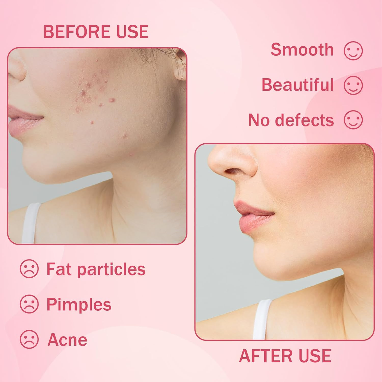 Black Blackhead Tool Kit,Stainless Steel Acne Needles Double Side Spot Squeezer Tool Pimple Extractor Popper Tool Kit Used to Remove Facial Blackheads and Pimples