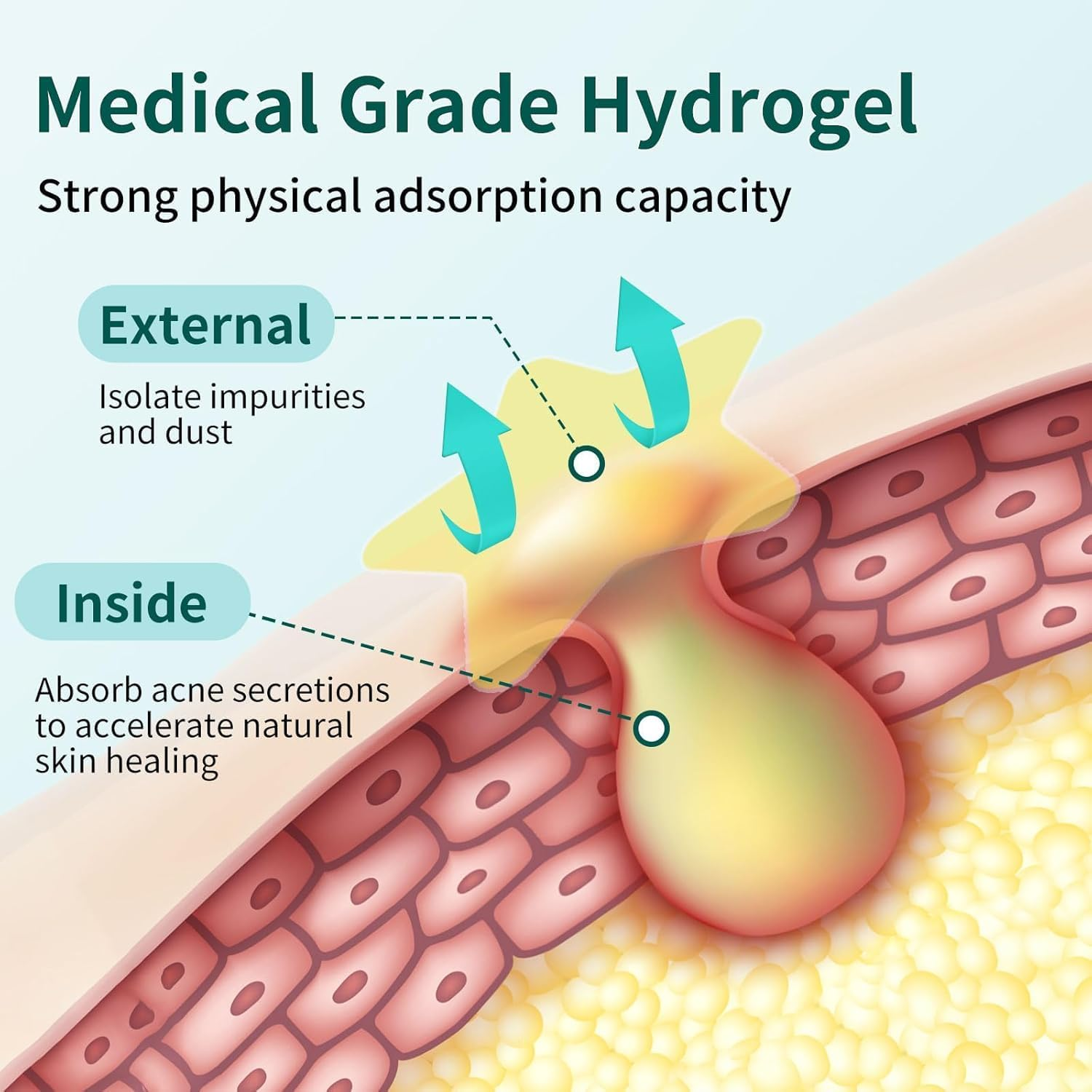 Pimple Patches - Coloured Star Hydrocolloid Acne Patches for Makeup & Cover | Blemish Absorbing Spot Treatment Stickers | Invisible Xmas Gift (5 Sheets, 255 Pcs)