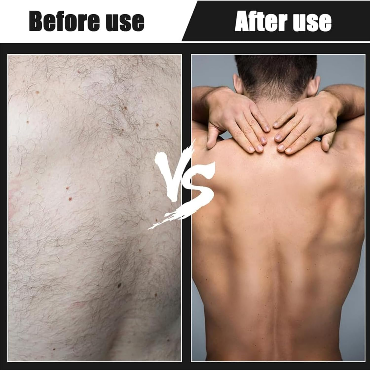 Men'S Back Razor with 5 Blades, Foldable Body Razor for Back Shaving, Ergonomic Handle, Wet & Dry Use, Removable Razor for Effective Shaving, Body Hair Trimmer for Men