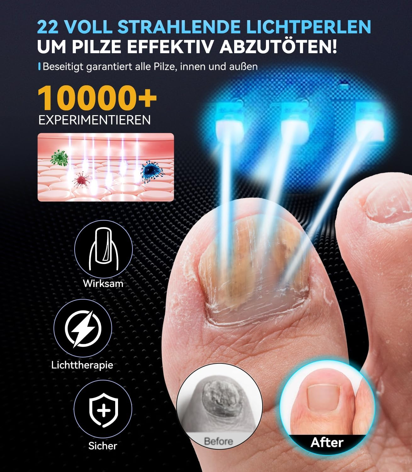 2025 6.0 Nail Fungus Lase, Dual Wavelength Technology, 470 Nm Blue & 905 Nm Infrared, Intelligent 3 Time 30S/60S/99S, Ultraportable Folding Design (White) Antifungal Laser - Black image number 4
