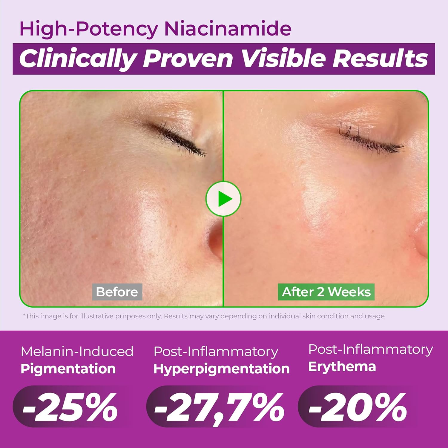 JUMISO Niacinamide 20 Serum - Korean Face Serum with Glutathione, TXA Tranexamic Acid and Centella Complex - Reduces Pigmentation, Uneven Skin Tone, Pore Care for Sensitive Skin, 1.35 Fl.Oz.