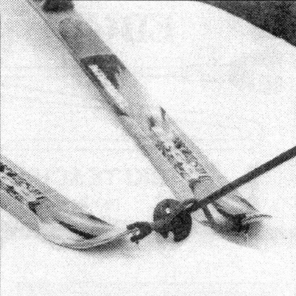 Slope Ropes X Edgie Wedgie Learn-To-Ski Pack