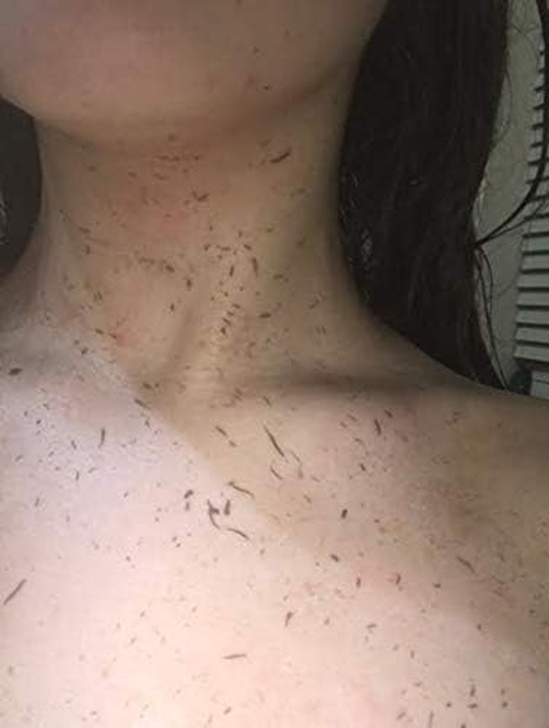 Feggari Peeling Exfoliating Glove image number 4