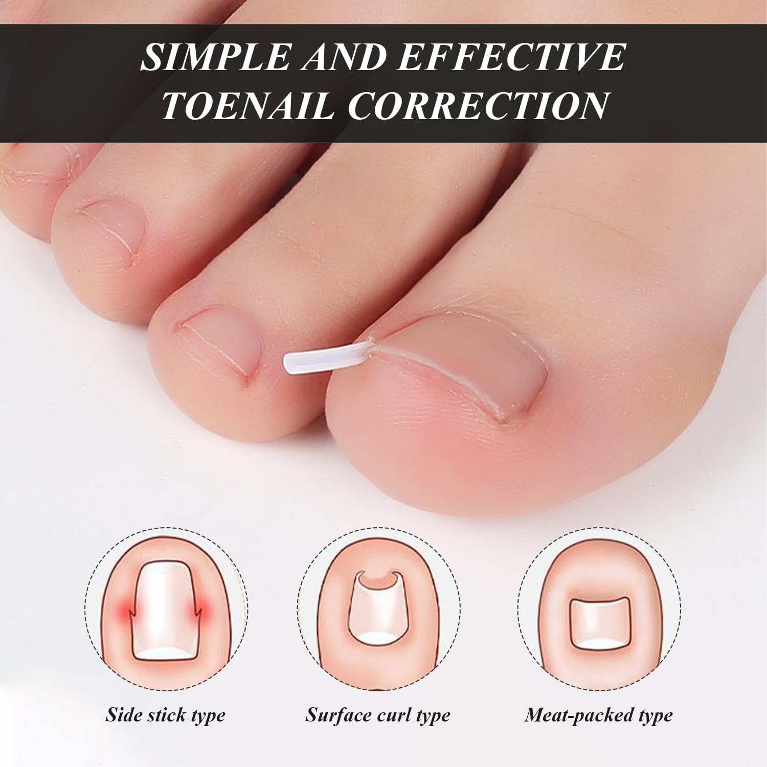 1 Piece Nail Clippers, 1 Piece Nail Picker, 50 Pieces Inline Nail Smoother, Zegel Filler Pads, Painless Zegel Smoother, Zegel Lift Set image number 4