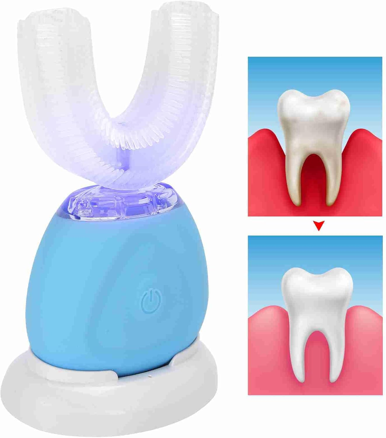 Electric Toothbrush Adults, Ultrasonic U-Shaped Toothbrushes with Wireless Charging & LED Light for Teeth Whitening - 360&deg; Mouth Cleansing, Hands Free Gums Protection, 3 Gear Speed image number 2