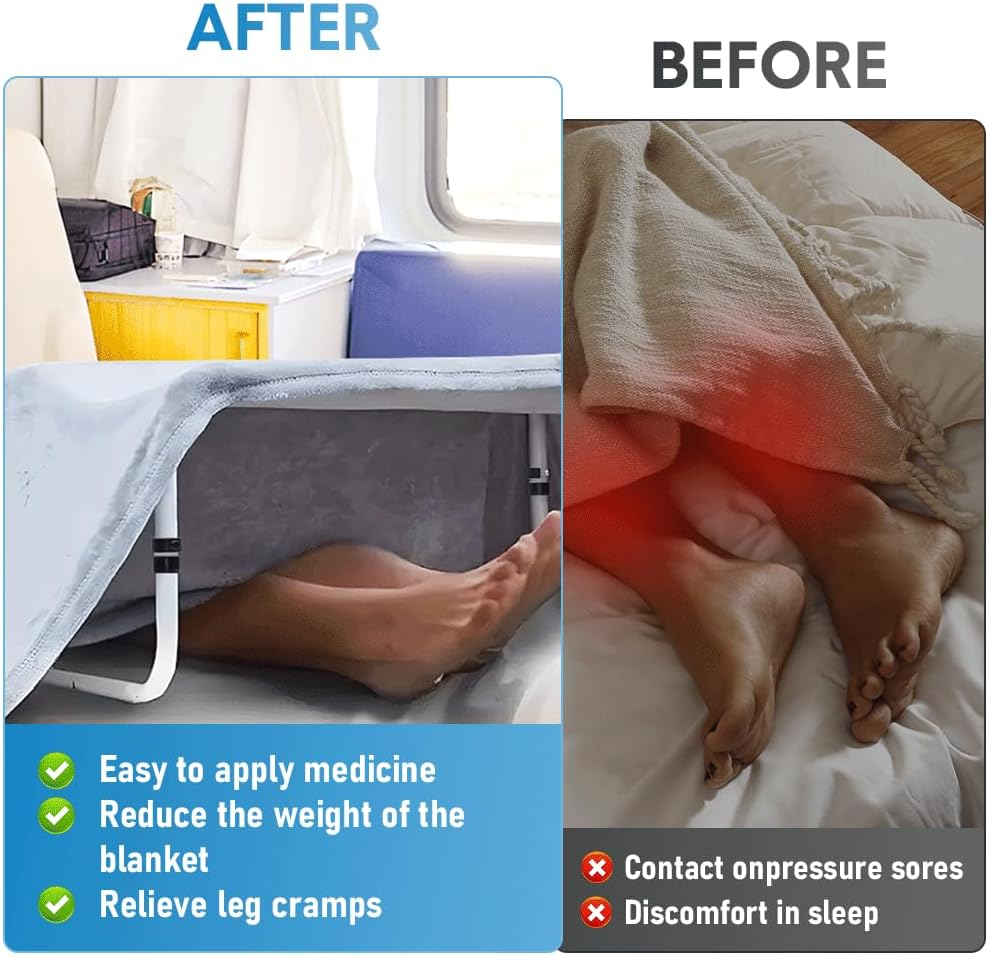 ALSTON Blanket Lifter Bar 65-85Cm Height Adjustable Feet Tent Steel Bed Cradle Max Load 136Kg with 4 Clips for Feet Toes Leg Knee Ankle Post Surgery Recovery