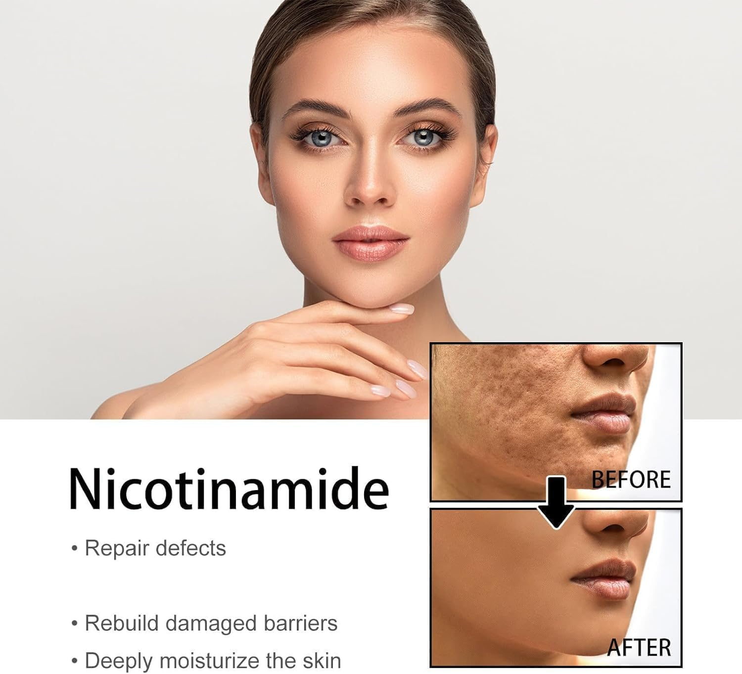 2Pcs Nicotinamide Serum for Blemishes,Niacinamide Freckles Removal Serum,Niacinamide Spots Removal Serum,Niacinamide Serum for All Type Skin image number 3