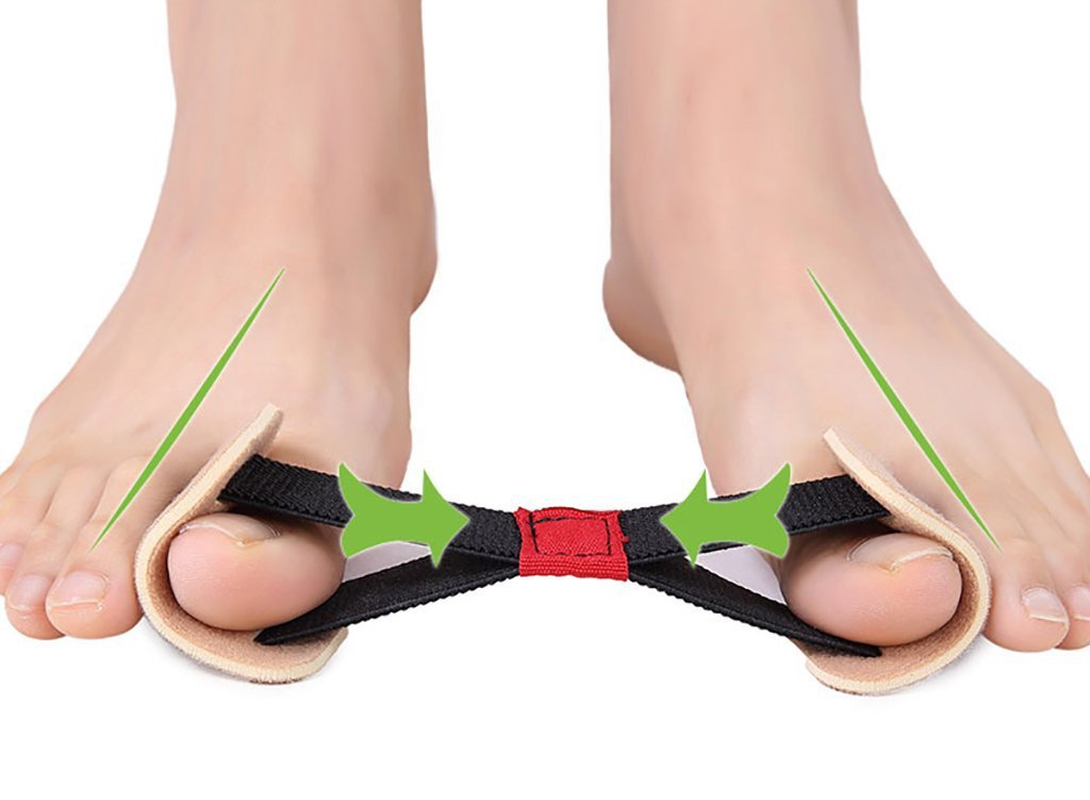 Big Toe Strap Bunion Straightener Stretchy Belt Toe Stretcher Alignment Hallux Valgus Corrector Foot Pain Relief