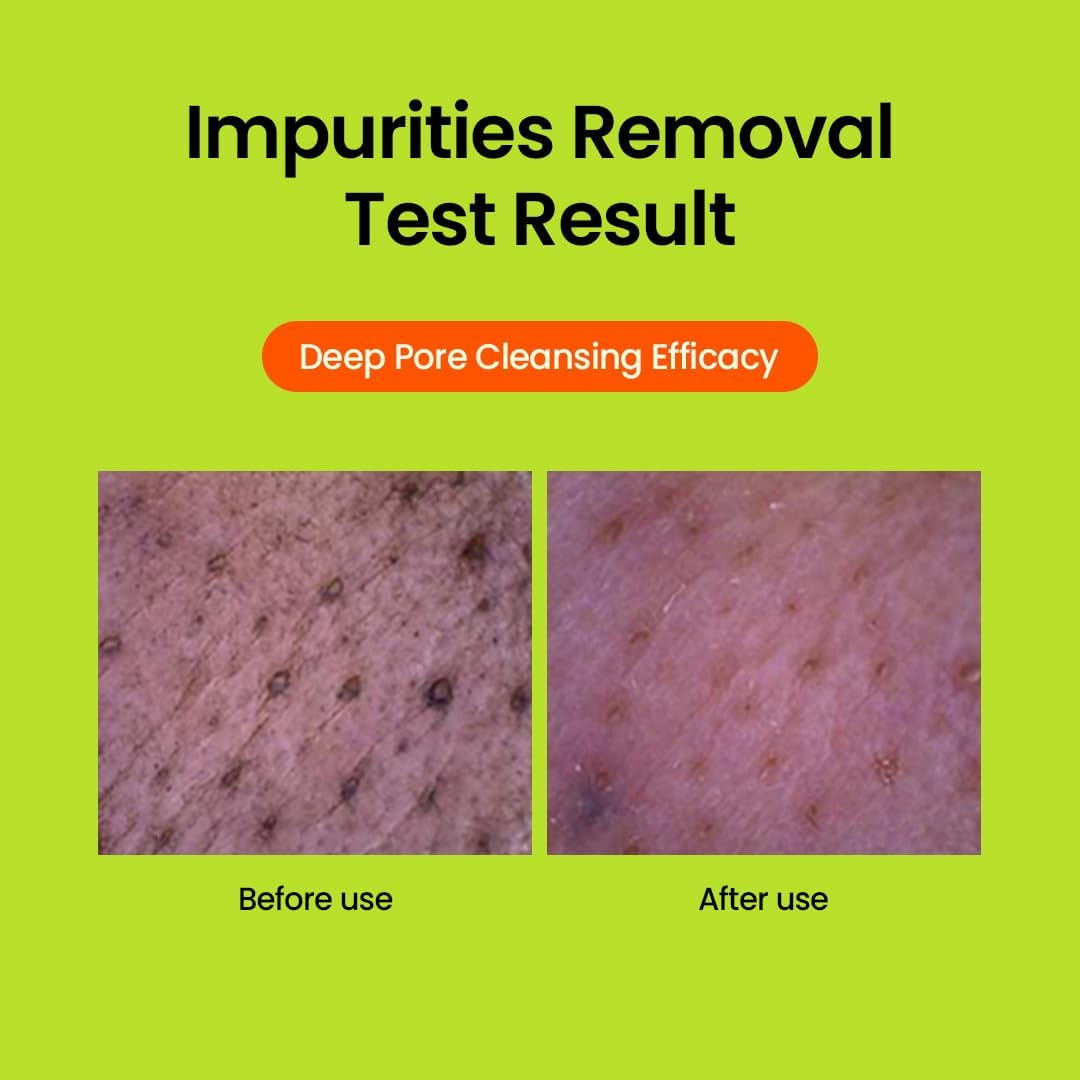 Greenful Ph-Balanced Cleansing Foam 80Ml/160Ml 160Ml