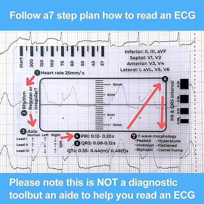 ECG 7Step Ruler,Ecg Ruler Plastic Ruler Measuring Tool,Ecg 7Step Ruler for ECG/EKG Interpretation,Transparent EKG Calipers 7Step Ruler,Follow a 7Step Plan ID Sized for Nurse or One in Healthcare (2) image number 6