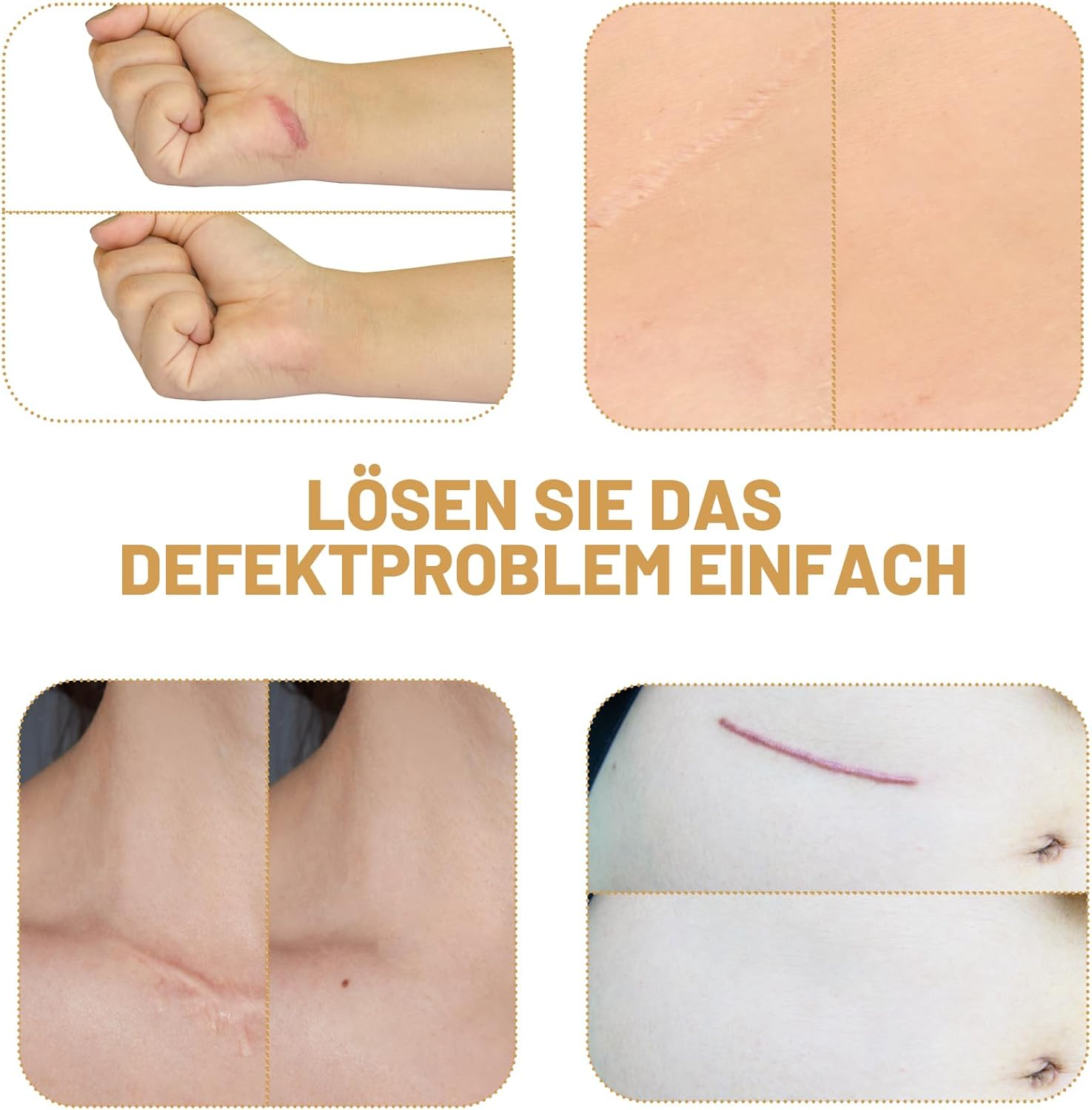 Pack of 15 Tattoo Covers, Waterproof, Tattoo Cover up Plasters, Skin-Friendly and Breathable, Ideal for Formal Occasions and Daily Use, 50 G image number 5