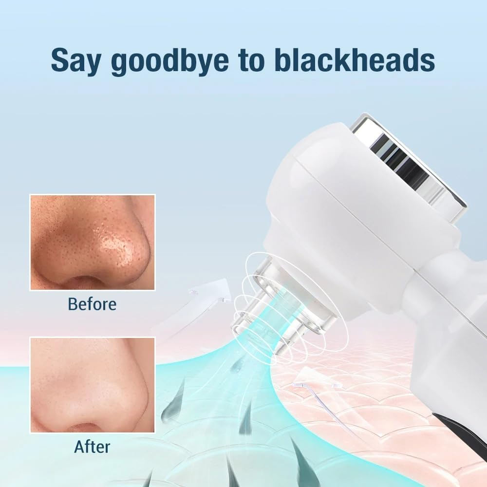 Blackhead Remover, Black Heads Remover with Hot Compress, 4 Adjustments Pore Vacuum Cleaner, Blackhead Vacuum with 6 Suction Cups, USB Charge, Pore Cleaner for Men & Women. image number 6