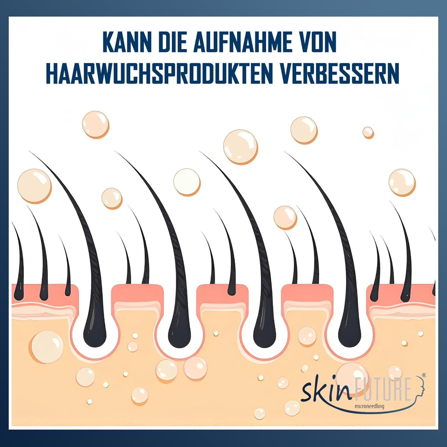 Efficient Microneedling Derma Roller Men - 192 Real Stainless Steel Needles against Hair Loss | Hair Roller & Beard Roller for Hair Growth | Minoxidil Compatible | Beard Care Tool - Skinfuture&reg; image number 5