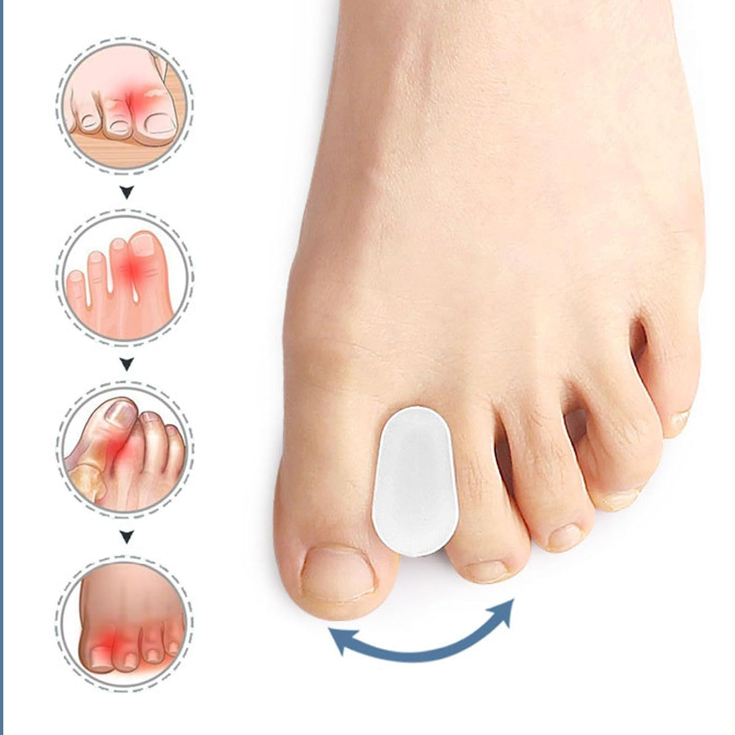 Xolixorium 10 Pack Toe Spacers Separators - Premium Gel Toe Separators for Bunion Discomfort and Overlapping Toes Care Everyday Comfort Toe Spacers L Size image number 5