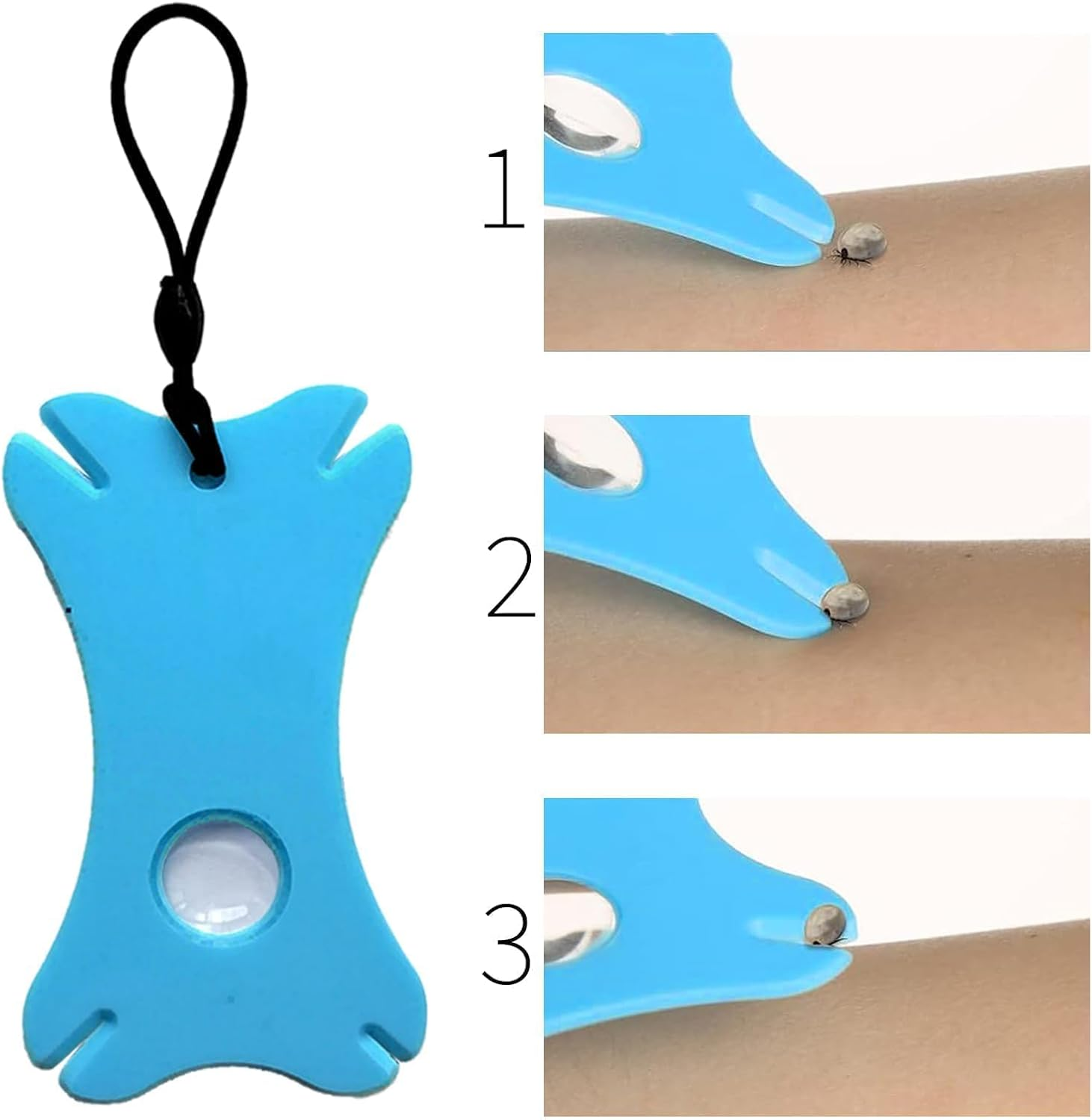 ANBOO 7-Piece Tick Removal Tool Set, 2 Tick Cards, Tick Tick Tweezers, Tick Comb, 3 Tick Hooks, Tick Card with Magnifying Glass, for People, Children, Dogs, Cats, Ideal for Outdoor Activities image number 1