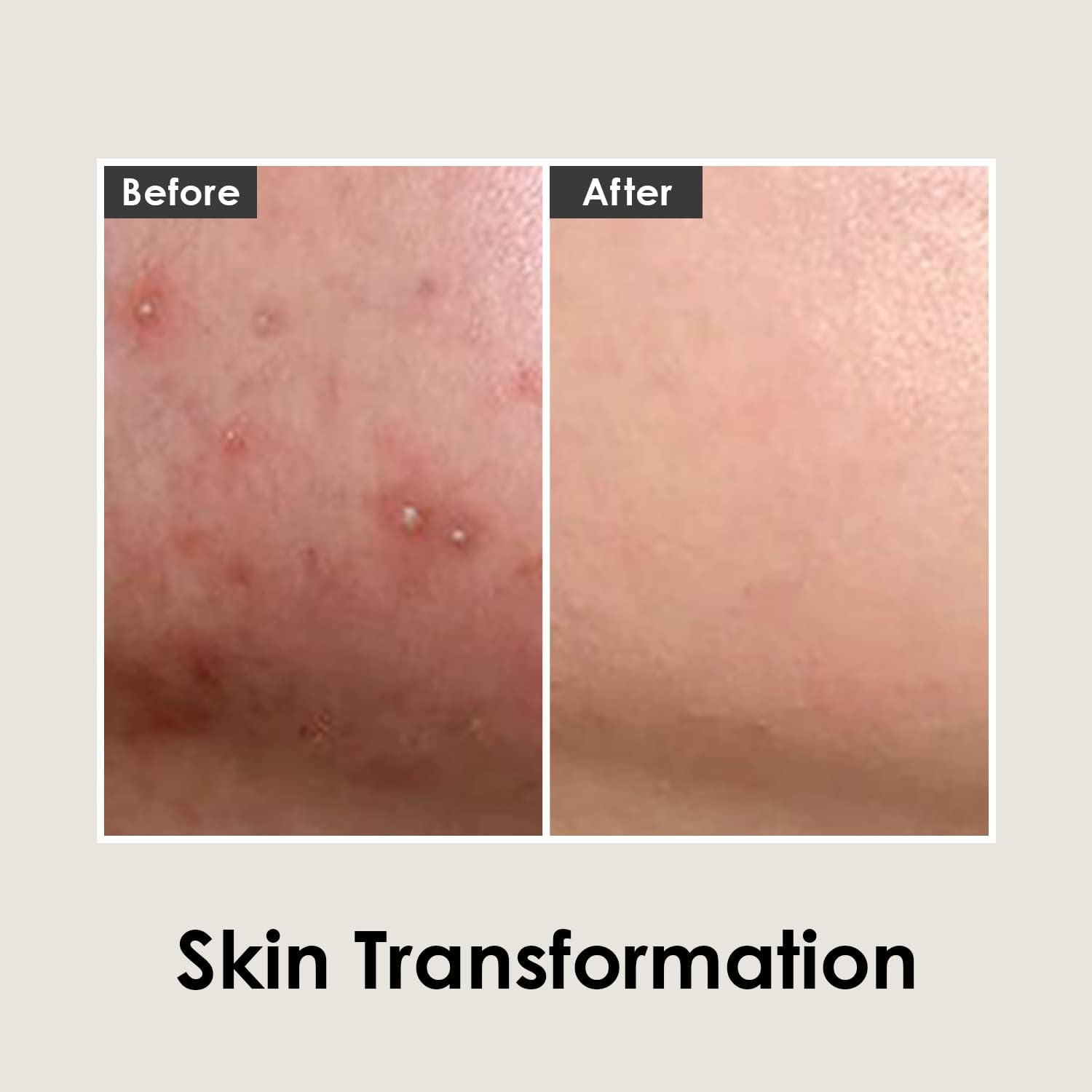 Cica Antio Cream 30Ml