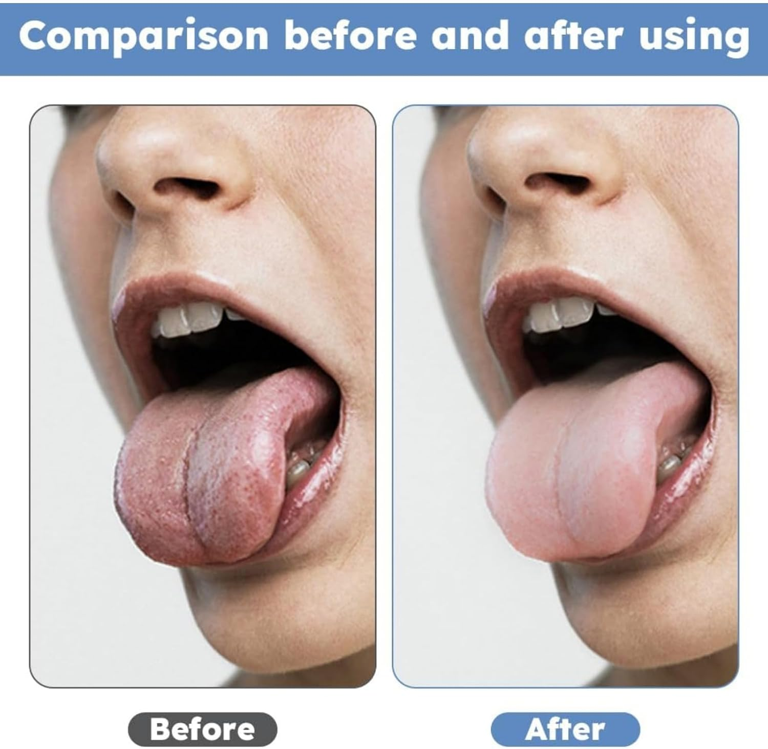 RODISHOMM Stainless Steel Tongue Scraper & Cleaner for Adults &ndash;2 Pack Metal Tongue Brush, Reduces Bad Breath & Freshens Breath with Storage Box image number 6