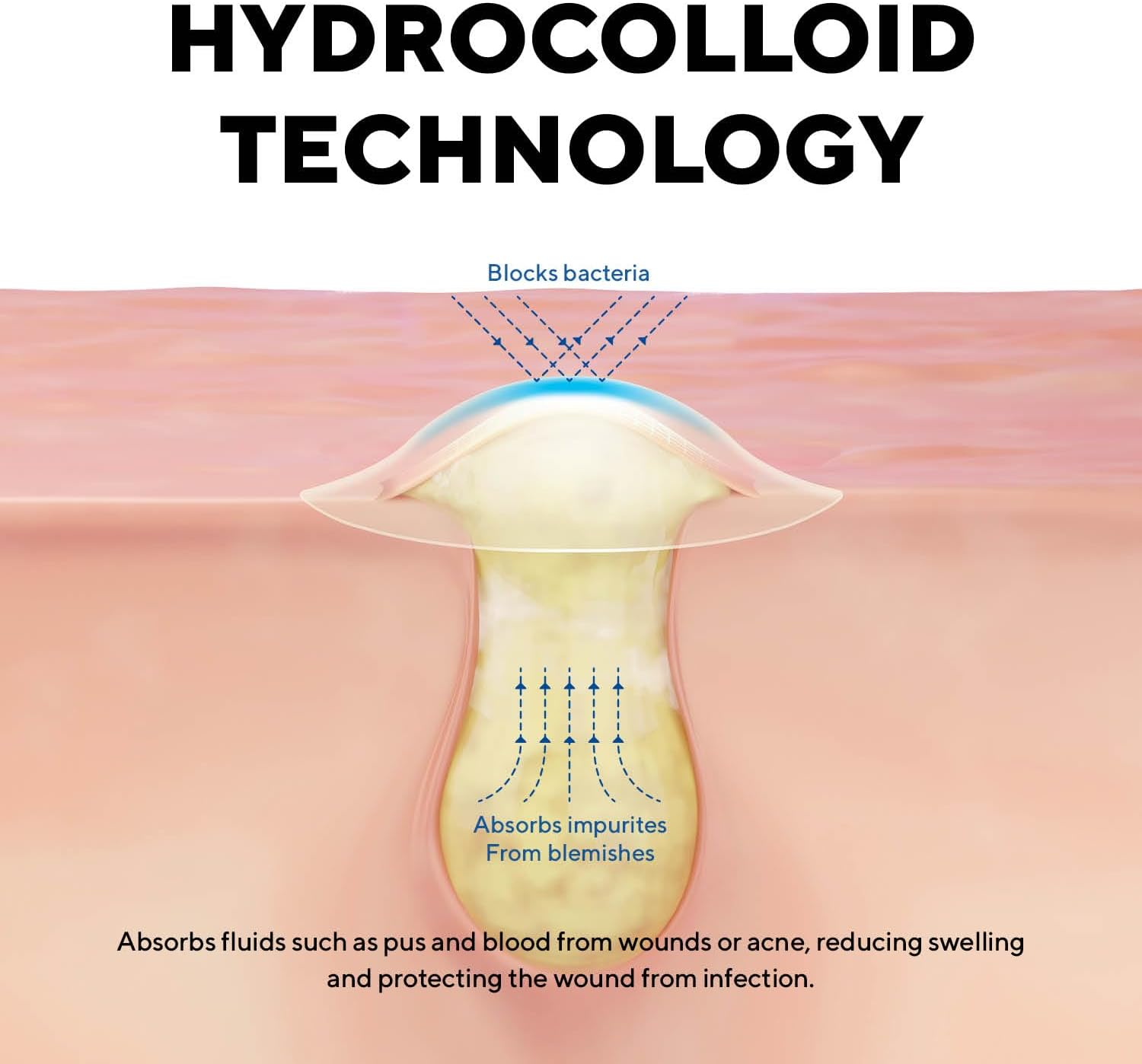 Pimple Patches, 2 Size Hydrocolloid Acne Patch for Zits and Blemishes, Bakuchiol & Aloe Vera, Korean Skin Care, Hassle Free Use &ndash; Dermatology Tested image number 3