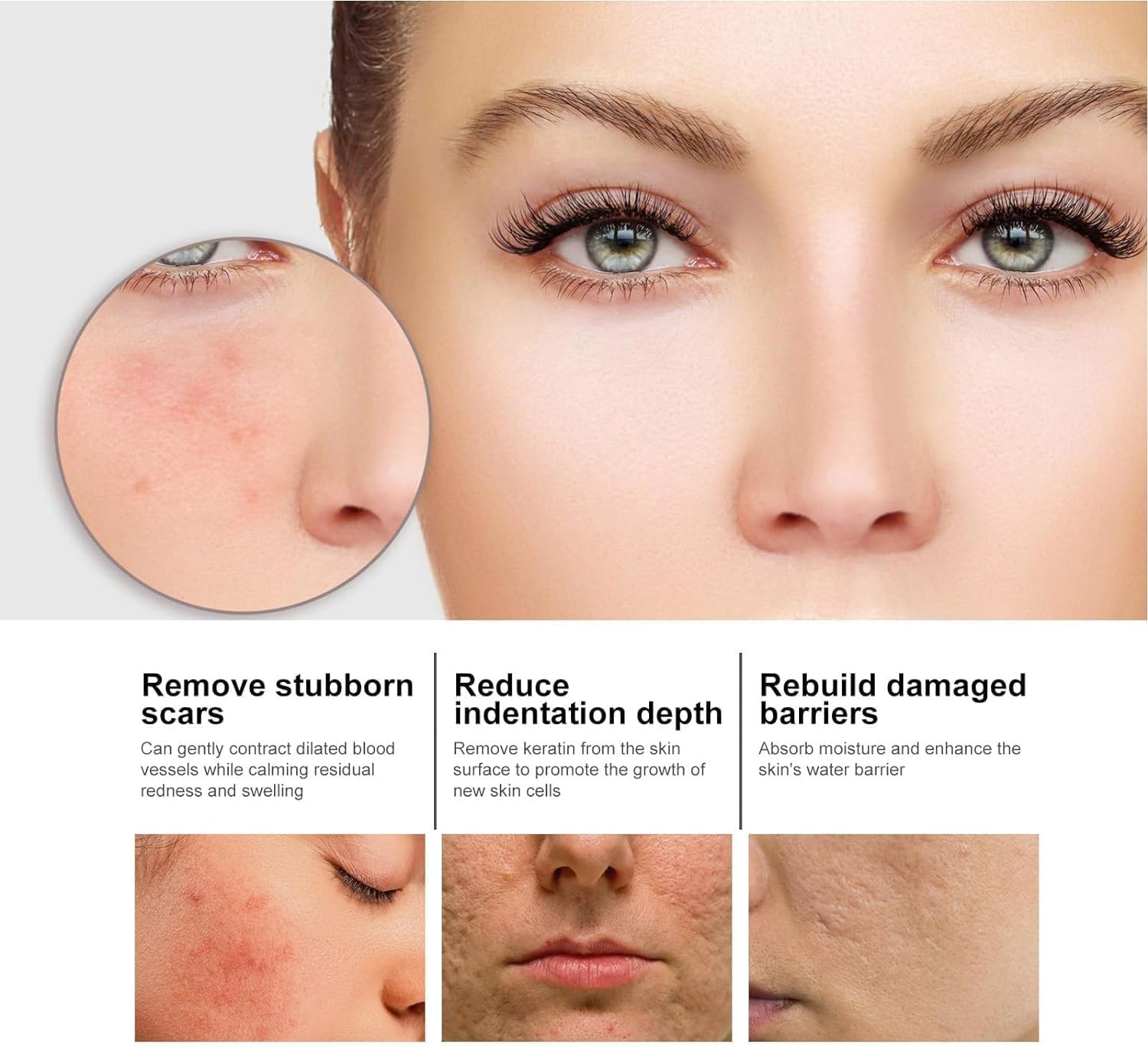 2Pcs Nicotinamide Serum for Blemishes,Niacinamide Freckles Removal Serum,Niacinamide Spots Removal Serum,Niacinamide Serum for All Type Skin image number 4