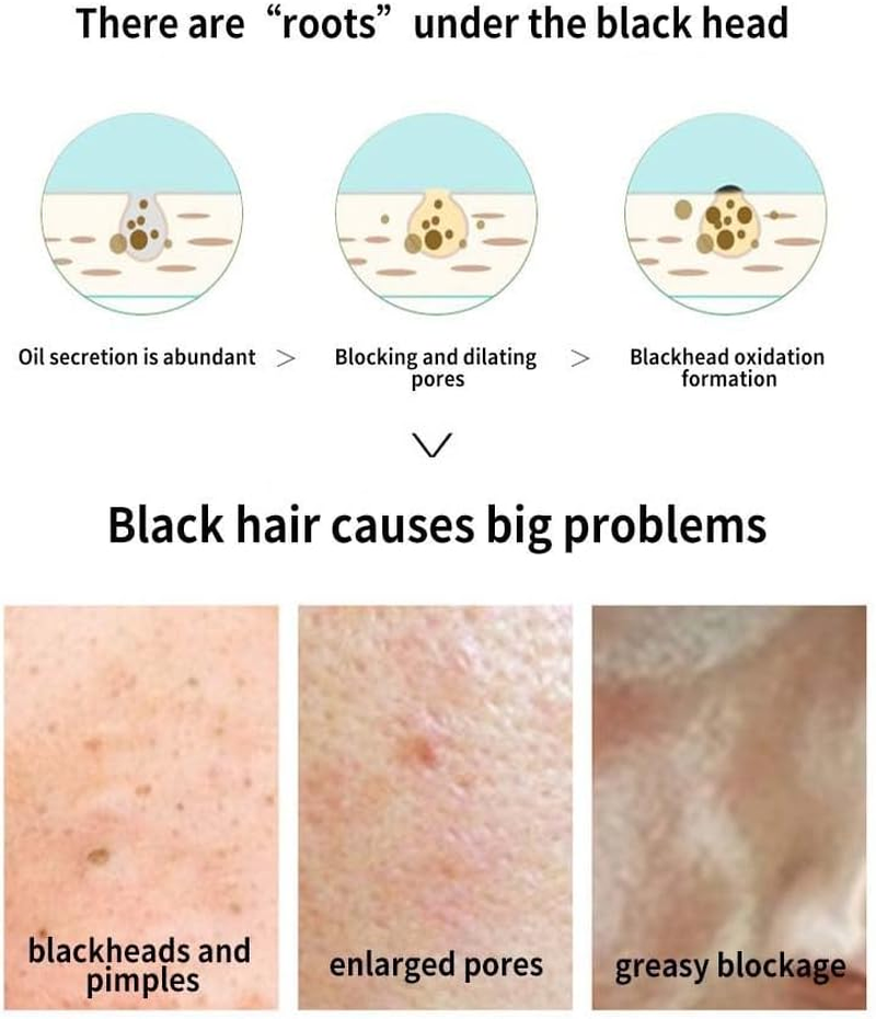 Vavilente Blackhead Remover,Nose Strips for Blackheads, Deep Cleansing Biore Pore Strips，Skin Care Tools,Blackhead Strip for Face Nose,Pore Scrubber with Natural Charcoal(10 Count) image number 1