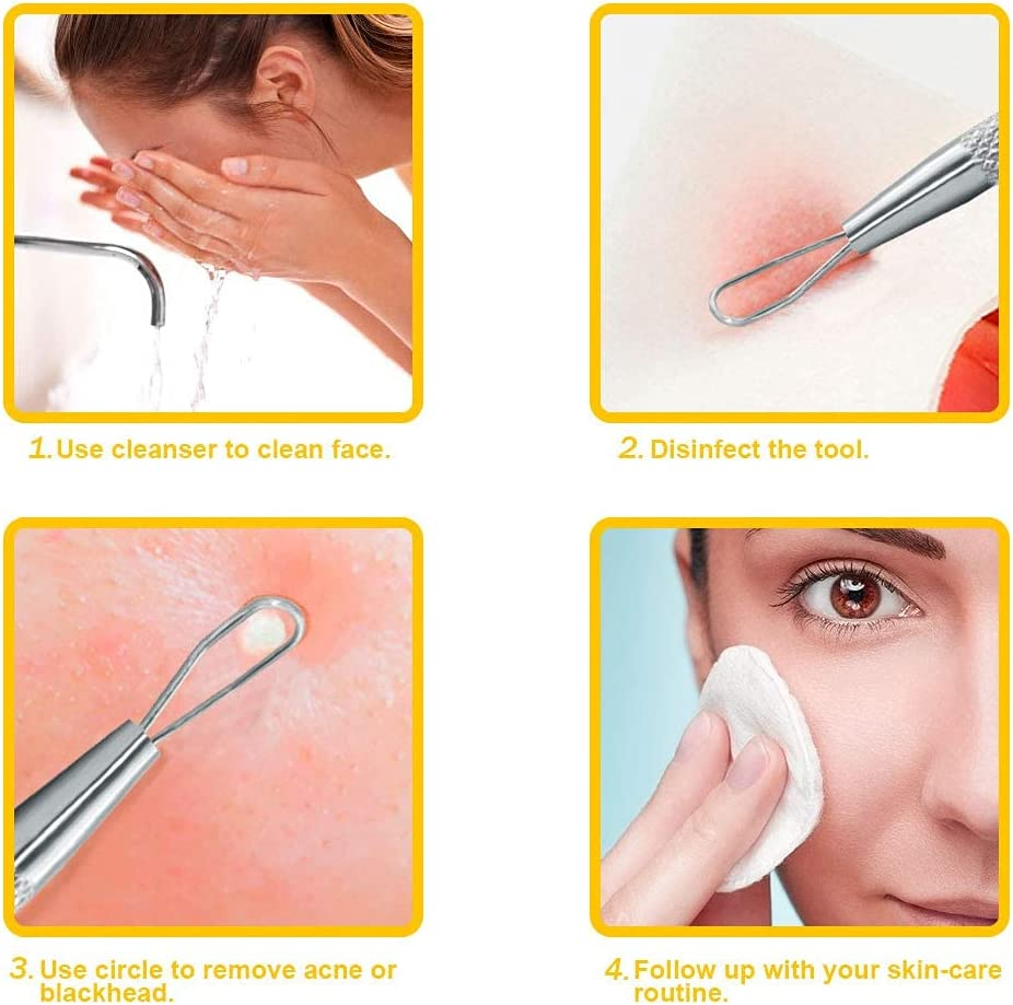 Blackhead Remover Pimple Popper Extractor &ndash; Stainless Steel Acne Removal Kit &ndash; by DMX INTL image number 6