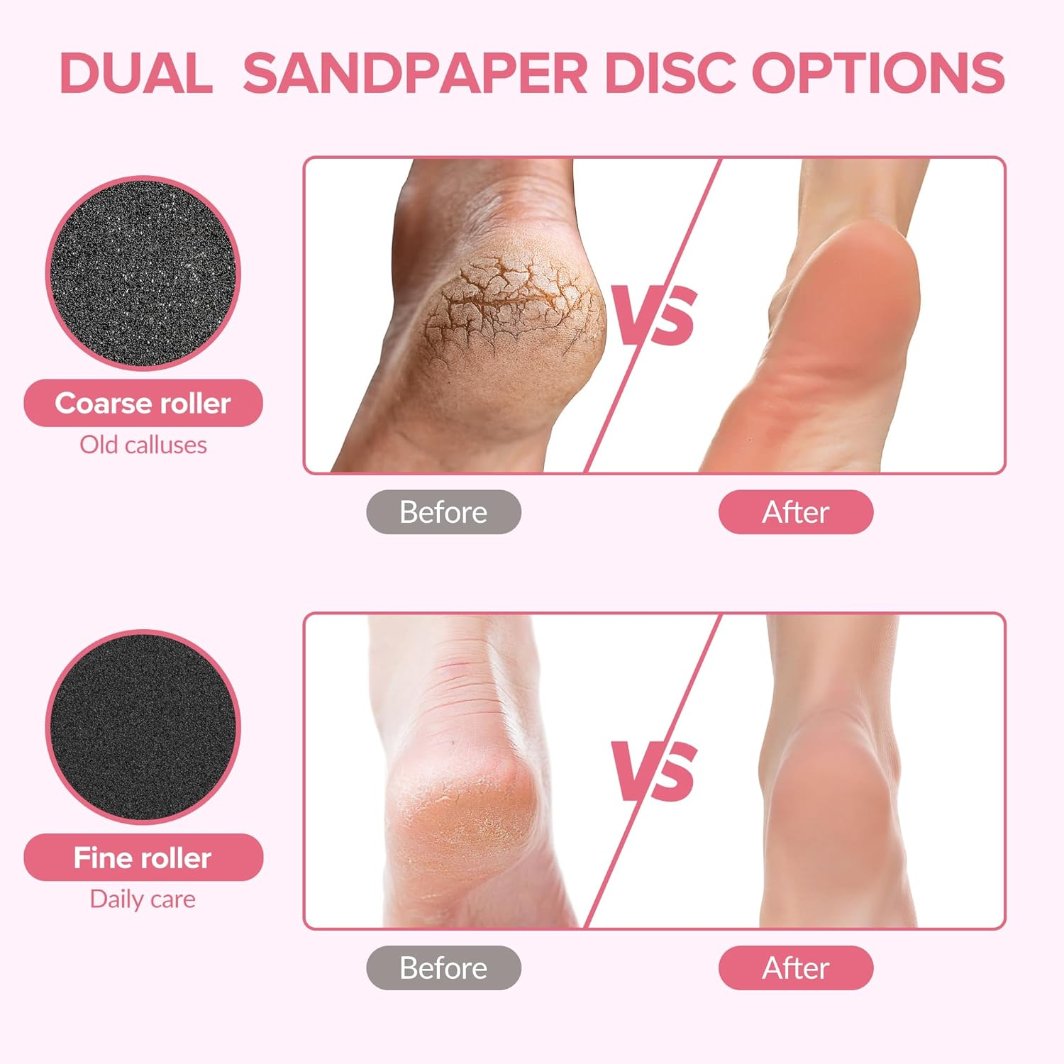 Electric Callus Remover for Feet，Electric Foot Care Tools，Stepless Speed Rechargeable Grinder with 60 Sandpaper Discs, Professional Pedicure Tool for Dead Dry Crack Skin Calluses-Black 004 image number 4