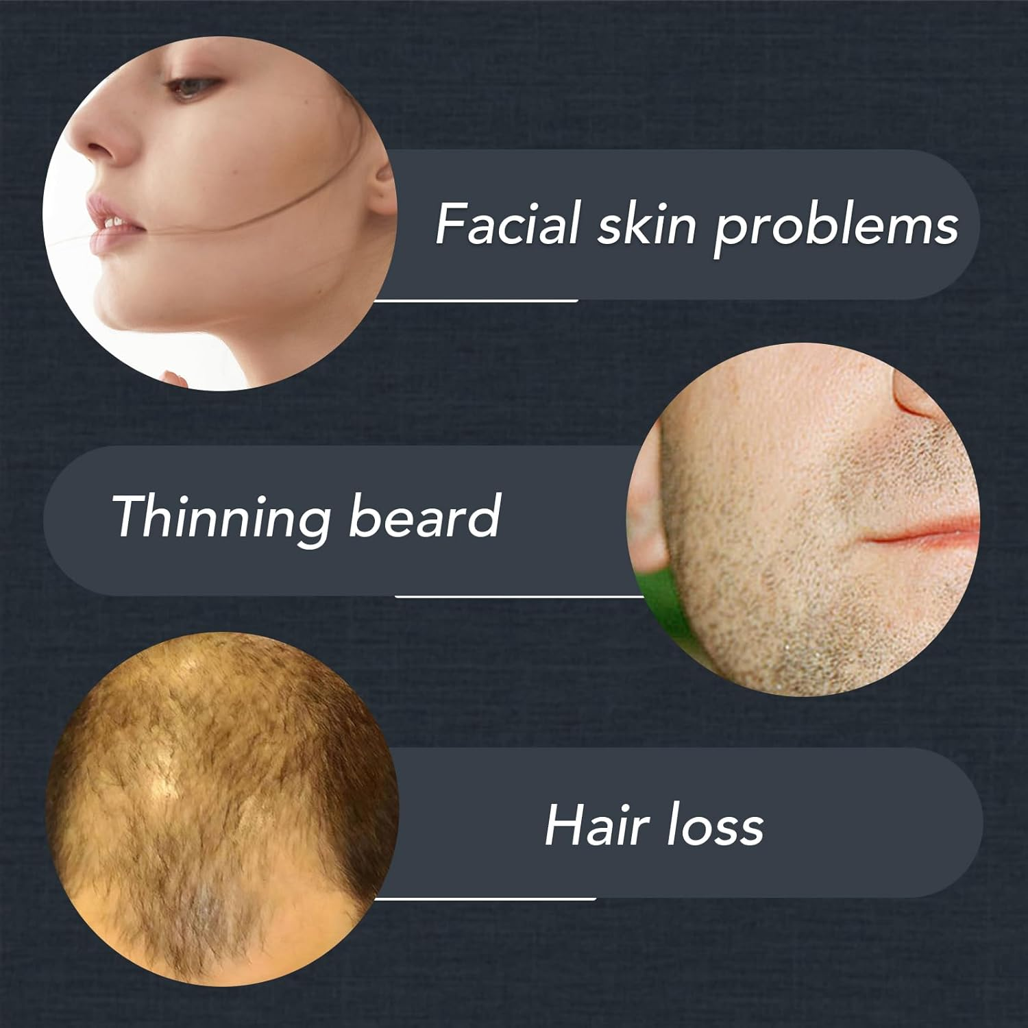 Dr.Roller Beard Roller 0.5 Mm, Derma Roller Hair, Beard Growth, Microneedling Roller, Derma Roller with 540 Micro Titanium Needles for Face, Scalp, Hair Loss, Scars image number 1