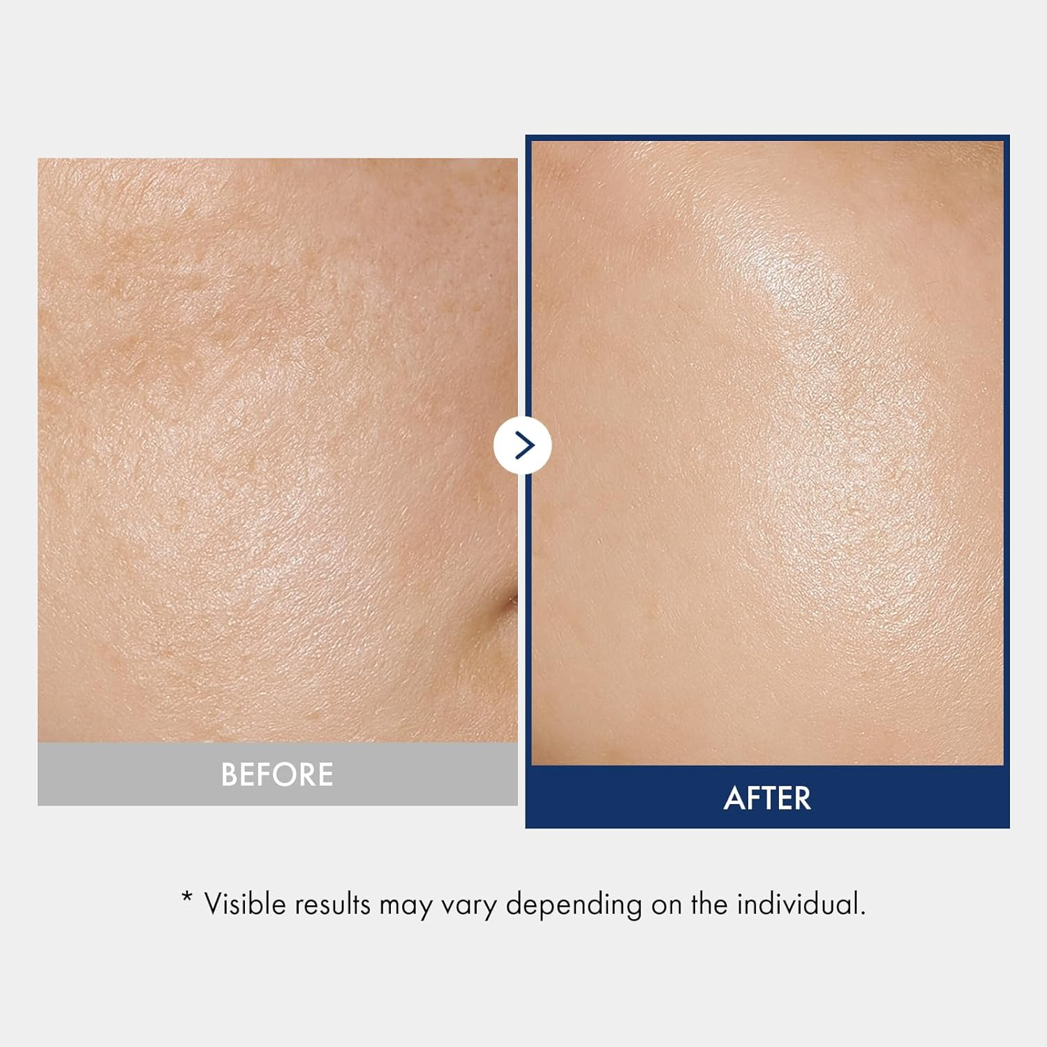 TOSOWOONG Ceramide Barrier Serum, Hydrating Serum for Face, 2,000Ppm Ceramide Complex, Niacinamide, Collagen, Panthenol, Centella, Glass Skin, Fragrance-Free, Korean Skin Care, 33 Ml / 1.11 Fl. Oz. image number 2