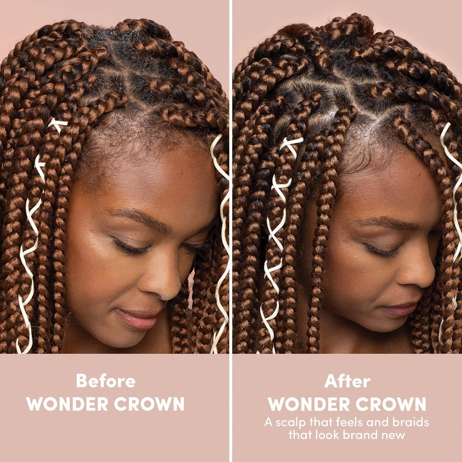 Mizani Wonder Crown Scalp Cleanser | Dry Scalp and Dandruff Treatment | Helps Stimulate Hair Growth | Removes Buildup and Oil | with Tea Tree and Peppermint Oil | for Dry, Itchy Scalps | 6.8 Fl Oz image number 1