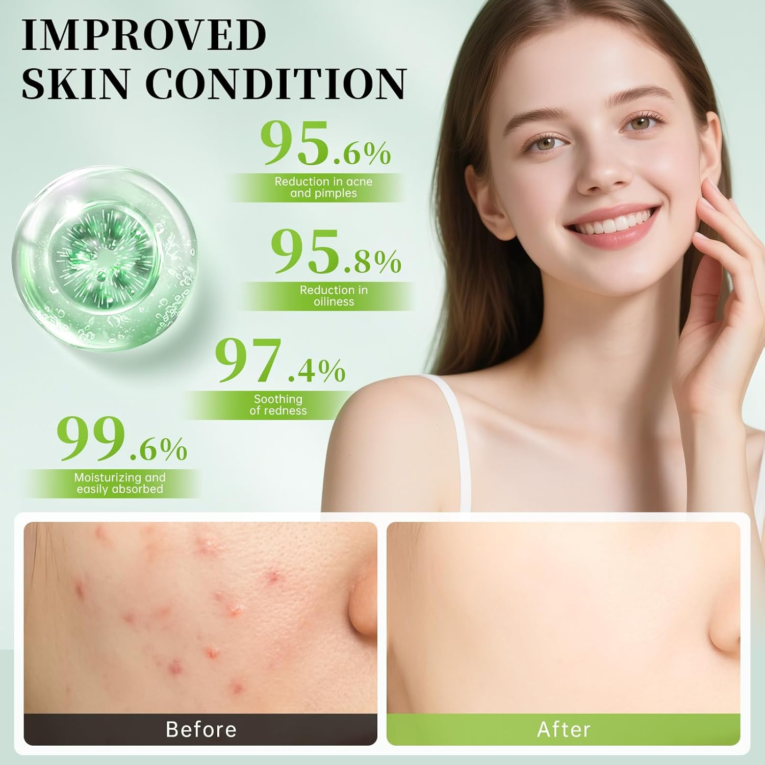 Azelaic Acid Face Serum, Azelaic Acid 10% Hyaluronic Acid Serum for anti Aging, Reduces Acne, Boosts Skin Fimness & Improves Skin Tone, Korean Skincare for All Skins, 30Ml