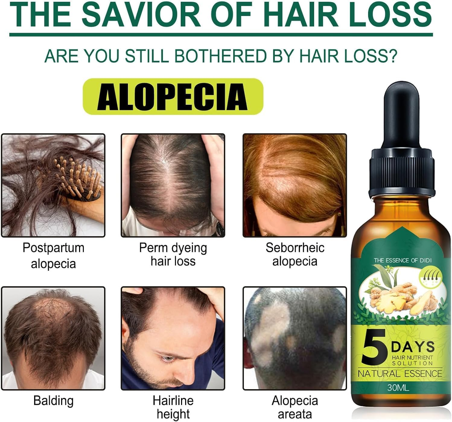 3 Pcs Prox Shouga Essence Hair Growth Oil,Prox Shouga Kingu Hair Growth Oil,5 Days Ginger Germinal Oil,Hair Oil for Growth and Anti-Hair Loss image number 3