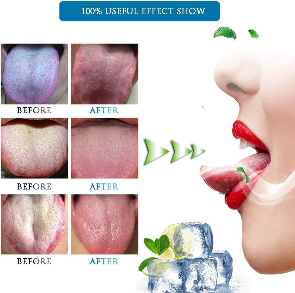 [Soft Silicon] 3PCS Tongue Scraper Cleaner, Oral Scrapers, Premium Sweeper Sets, Bad Breath Cure Tools, Effective Kits