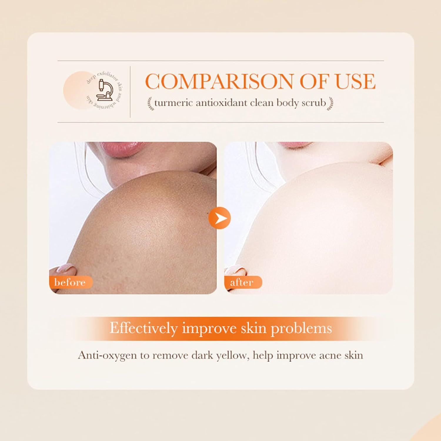 Turmeric Sugar Scrub - Hydrating Brightening Scrub - Body Exfoliator for Scars & Stretchmarks, Great for Daily Use, Turmeric Lightening Scrub for Face & Body, 240G image number 6