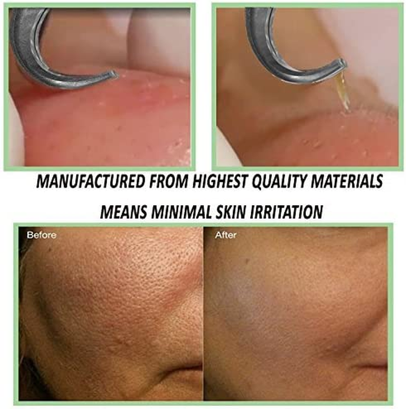 Blackhead Remover Kit - FEITA Blackhead Tweezers Removal Tool Kit Set - Acne Tweezers Pimple Comedone Extractor with Travel Case (5 Pcs) image number 2